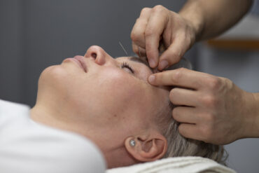 Can Acupuncture Help with Cancer Treatment Side Effects?