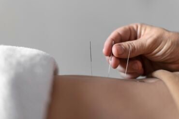 Acupuncture Improves Quality of Life in Head and Neck Cancer Patients During Radiotherapy — New Trial